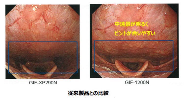 極細ハイビジョン内視鏡オリンパスGIF-1200N>のイメージ写真